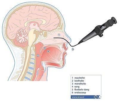 Endoscopie