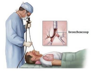 Arts die met bronchoscoop de longen van een patient bekijkt