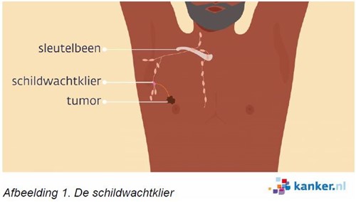 Illustratie van de schildwachtklier in het lichaam van een man
