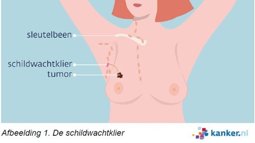 Afbeelding van de schildwachtklier