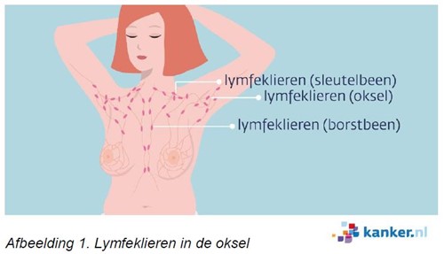 Illustratie van lymfeklieren in de oksel