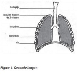 Thorax drain inbrengen 2