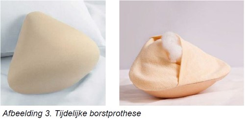 tijdelijke borstprothese