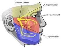 illustratie met uitleg van ganglion gasseri